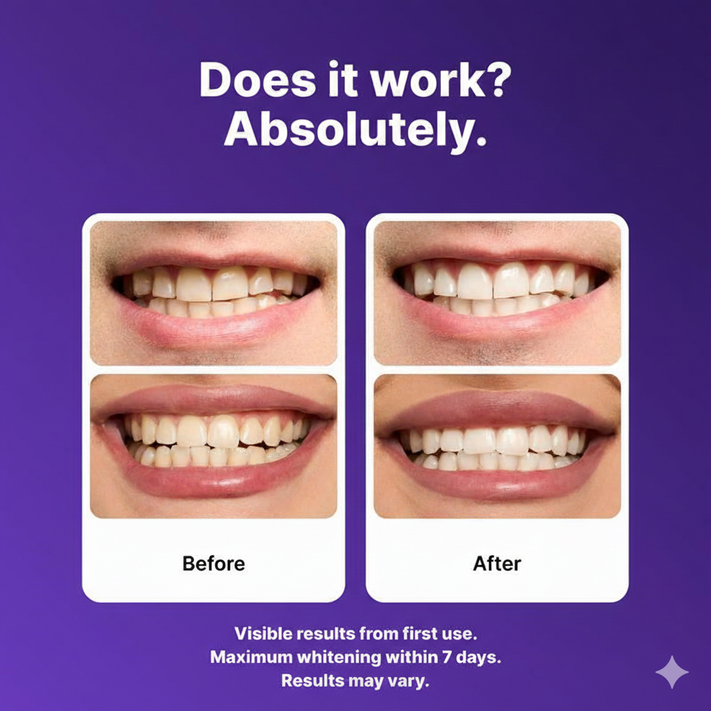 ORVINOS™ Purple Teeth Whitening Strips