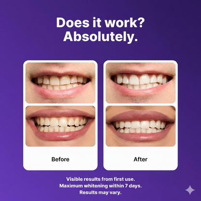 ORVINOS™ Purple Teeth Whitening Strips
